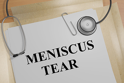 Meniscus Tear