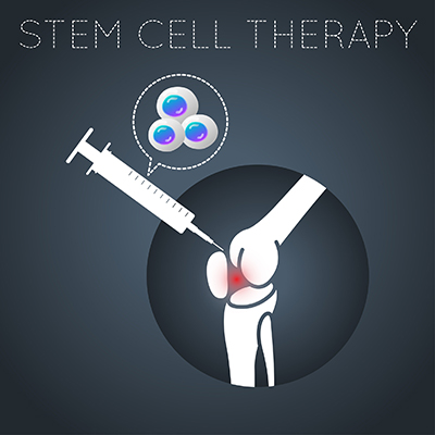 Stem Cell