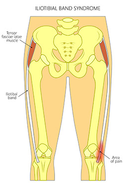 Knee Conditions Image