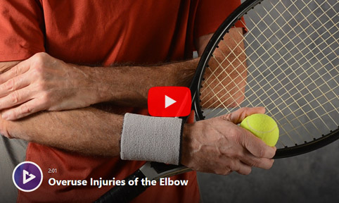 Elbow video