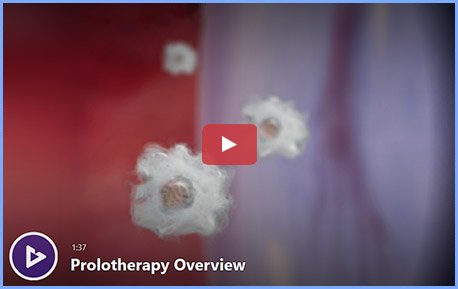 Prolotherapy video