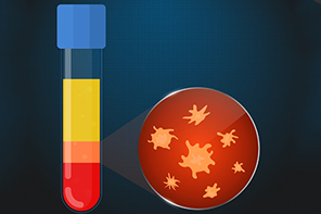 Platelet Rich Plasma Therapy