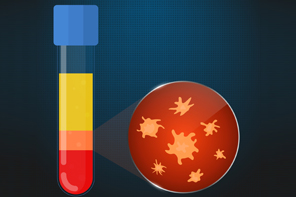 Platelet Rich Plasma Therapy