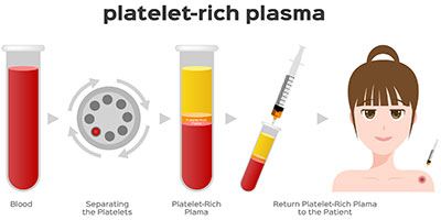 PRP: Procedure Snapshot