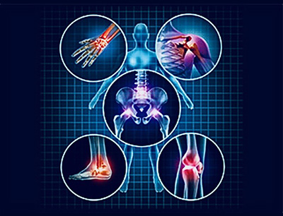 Regenerative Orthopedics