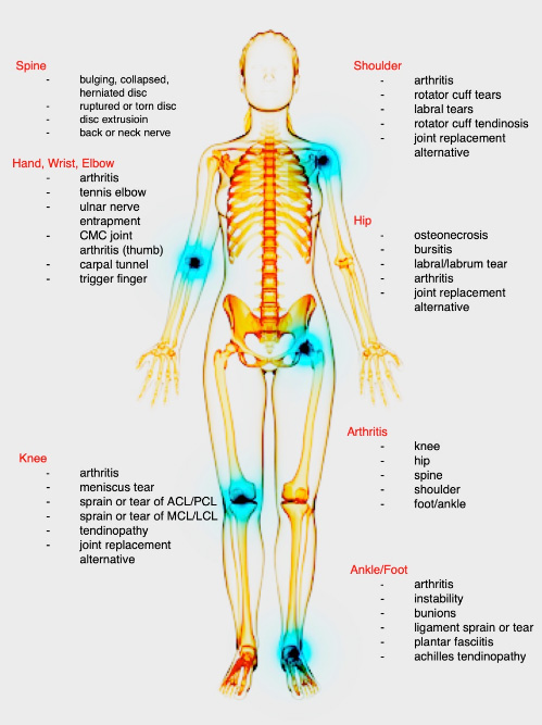 skeleton